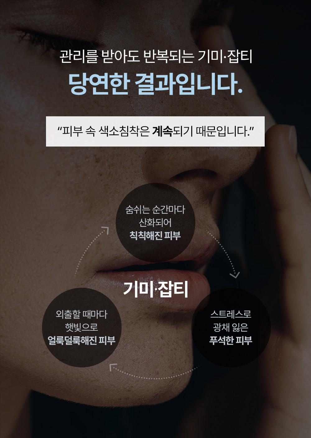 관리 받아도 반복되는 기미,잡티 당연한 결과입니다.