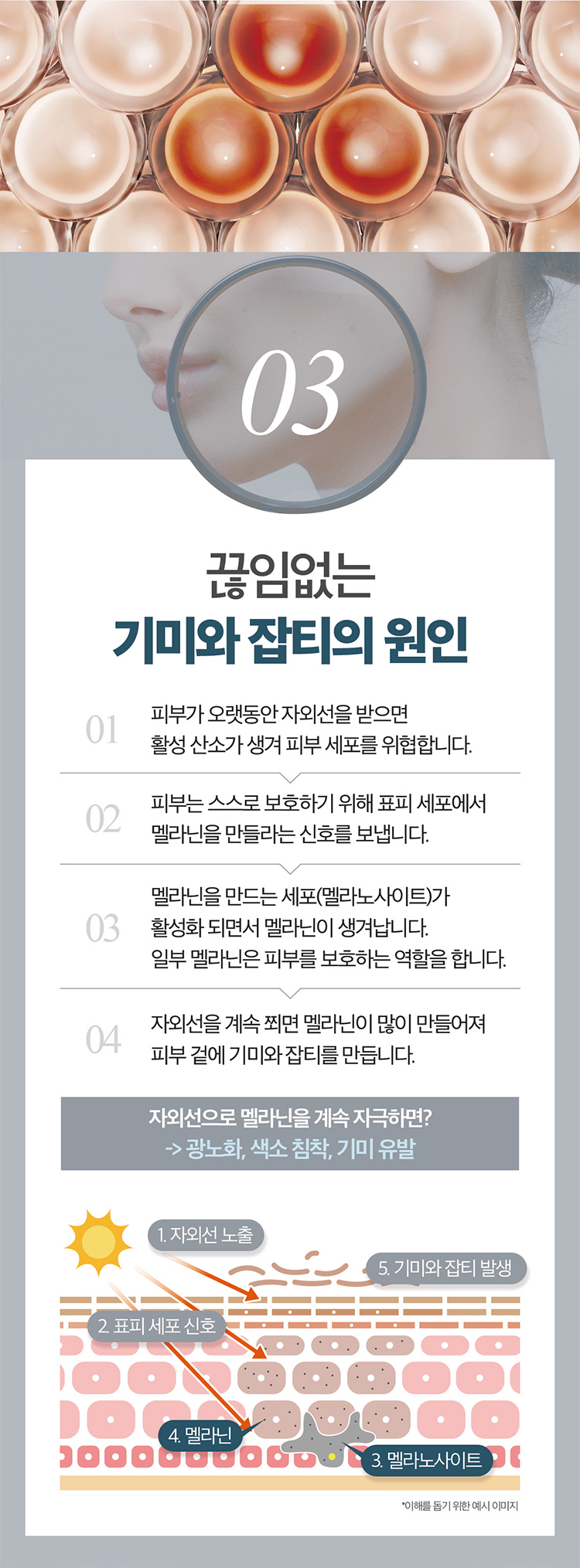 02 끊임없는 기미와 잡티의 원인