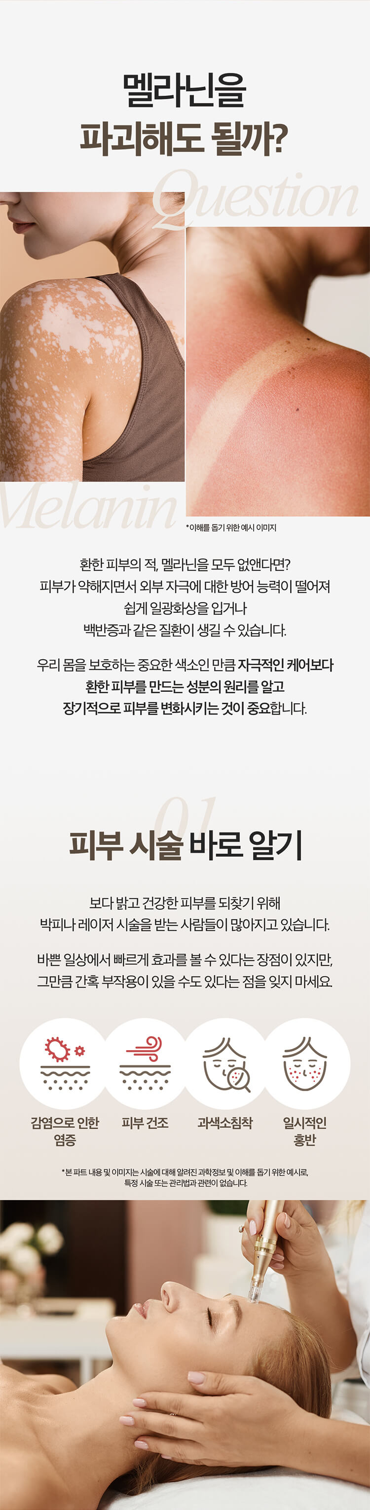멜라닌을 파괴회도 될까? 01 피부시술 바로 알기